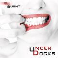 underdocks_re-burnt