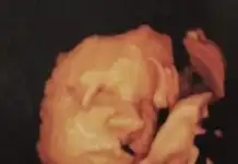 Brucherò nei pascoli – Umana