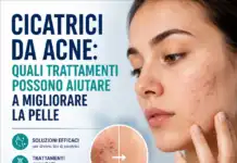 Cicatrici da acne: quali trattamenti possono aiutare a migliorare la pelle